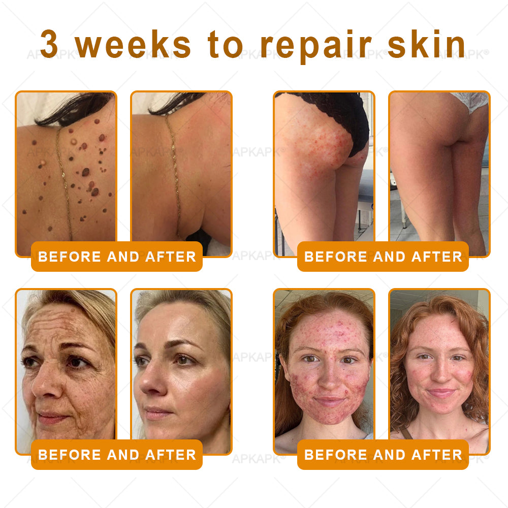 ⚡𝐌𝐇𝐑𝐀 𝐌𝐚𝐝𝐞 𝐚𝐧𝐝 𝐬𝐡𝐢𝐩𝐩𝐞𝐝 𝐟𝐫𝐨𝐦 𝐔𝐒𝐀✨𝗔𝗣𝗞𝗔𝗣𝗞® 𝗕𝗲𝗲 venom SkinRestoration Cream, Fine Lines, loss ofFirmness, Flat Bust, DroopingHips, and More