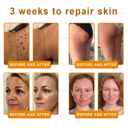 ⚡𝐌𝐇𝐑𝐀 𝐌𝐚𝐝𝐞 𝐚𝐧𝐝 𝐬𝐡𝐢𝐩𝐩𝐞𝐝 𝐟𝐫𝐨𝐦 𝐔𝐒𝐀✨𝗔𝗣𝗞𝗔𝗣𝗞® 𝗕𝗲𝗲 venom SkinRestoration Cream, Fine Lines, loss ofFirmness, Flat Bust, DroopingHips, and More