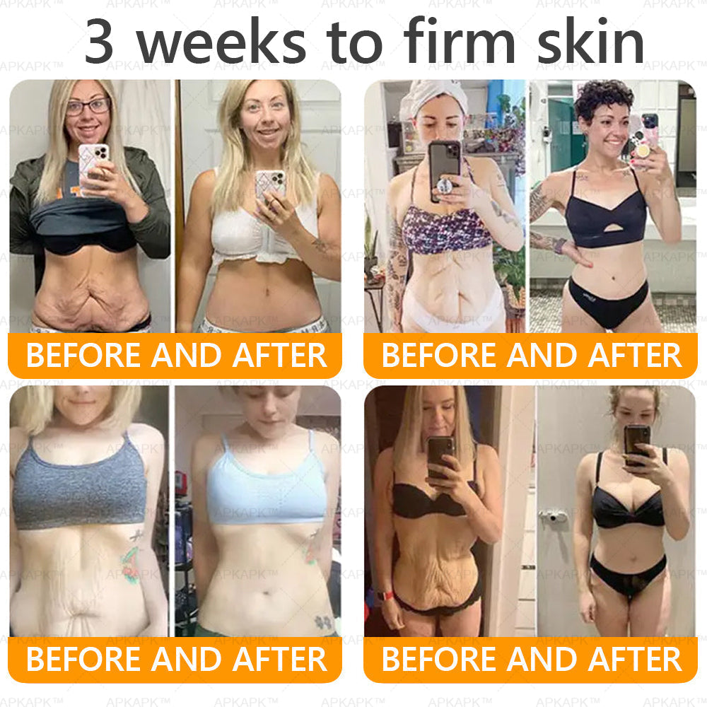 ⚡𝐌𝐇𝐑𝐀 𝐌𝐚𝐝𝐞 𝐚𝐧𝐝 𝐬𝐡𝐢𝐩𝐩𝐞𝐝 𝐟𝐫𝐨𝐦 𝐔𝐒𝐀✨𝗔𝗣𝗞𝗔𝗣𝗞® 𝗕𝗲𝗲 venom SkinRestoration Cream, Fine Lines, loss ofFirmness, Flat Bust, DroopingHips, and More
