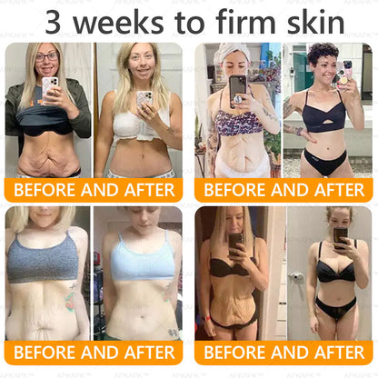 Made and Shipped from USA ✨✨✨  APKAPK® Bee venom Comprehensive Cream with Collagen & Matrixyl 3000|Obesity🔥 Sagging Skin, Fine Lines, Loss of Firmness, Flat Bust, Drooping Hips, and More