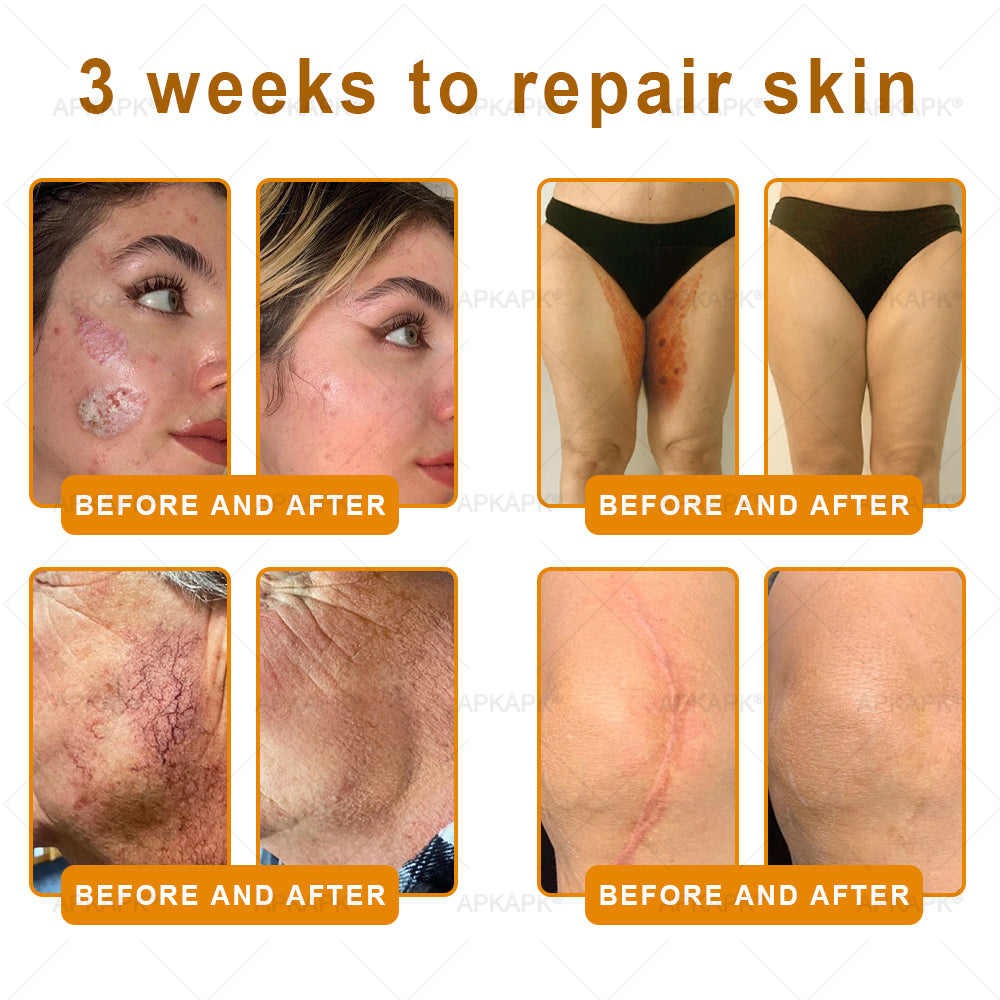 ⚡𝐌𝐇𝐑𝐀 𝐌𝐚𝐝𝐞 𝐚𝐧𝐝 𝐬𝐡𝐢𝐩𝐩𝐞𝐝 𝐟𝐫𝐨𝐦 𝐔𝐒𝐀✨𝗔𝗣𝗞𝗔𝗣𝗞® 𝗕𝗲𝗲 venom SkinRestoration Cream, Fine Lines, loss ofFirmness, Flat Bust, DroopingHips, and More