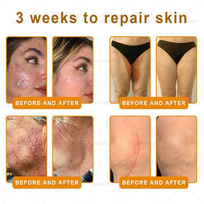 ⚡𝐌𝐇𝐑𝐀 𝐌𝐚𝐝𝐞 𝐚𝐧𝐝 𝐬𝐡𝐢𝐩𝐩𝐞𝐝 𝐟𝐫𝐨𝐦 𝐔𝐒𝐀✨𝗔𝗣𝗞𝗔𝗣𝗞® 𝗕𝗲𝗲 venom SkinRestoration Cream, Fine Lines, loss ofFirmness, Flat Bust, DroopingHips, and More