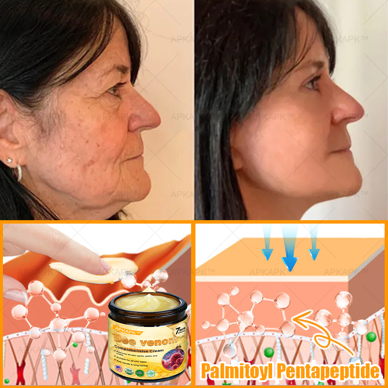 Made and Shipped from USA ✨✨✨  APKAPK® Bee venom Comprehensive Cream with Collagen & Matrixyl 3000|Obesity🔥 Sagging Skin, Fine Lines, Loss of Firmness, Flat Bust, Drooping Hips, and More