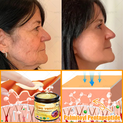 Made and Shipped from USA ✨✨✨  APKAPK® Bee venom Comprehensive Cream with Collagen & Matrixyl 3000|Obesity🔥 Sagging Skin, Fine Lines, Loss of Firmness, Flat Bust, Drooping Hips, and More