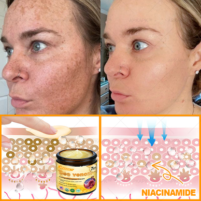 Made and Shipped from USA ✨✨✨  APKAPK® Bee venom Comprehensive Cream with Collagen & Matrixyl 3000|Obesity🔥 Sagging Skin, Fine Lines, Loss of Firmness, Flat Bust, Drooping Hips, and More