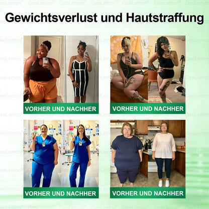 Gee𝐋𝐞𝐦on® Moringa · Berberin × NAD+ 10-in-1 Fortschrittliches Nano-Mikronadel-Pflaster⭐⭐⭐⭐