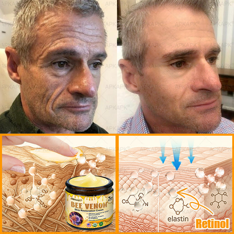 ⚡𝐌𝐇𝐑𝐀 𝐌𝐚𝐝𝐞 𝐚𝐧𝐝 𝐬𝐡𝐢𝐩𝐩𝐞𝐝 𝐟𝐫𝐨𝐦 𝐔𝐒𝐀✨𝗔𝗣𝗞𝗔𝗣𝗞® 𝗕𝗲𝗲 venom SkinRestoration Cream, Fine Lines, loss ofFirmness, Flat Bust, DroopingHips, and More