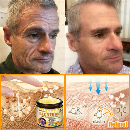 ⚡𝐌𝐇𝐑𝐀 𝐌𝐚𝐝𝐞 𝐚𝐧𝐝 𝐬𝐡𝐢𝐩𝐩𝐞𝐝 𝐟𝐫𝐨𝐦 𝐔𝐒𝐀✨𝗔𝗣𝗞𝗔𝗣𝗞® 𝗕𝗲𝗲 venom SkinRestoration Cream, Fine Lines, loss ofFirmness, Flat Bust, DroopingHips, and More