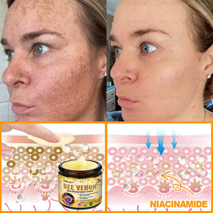 ⚡𝐌𝐇𝐑𝐀 𝐌𝐚𝐝𝐞 𝐚𝐧𝐝 𝐬𝐡𝐢𝐩𝐩𝐞𝐝 𝐟𝐫𝐨𝐦 𝐔𝐒𝐀✨𝗔𝗣𝗞𝗔𝗣𝗞® 𝗕𝗲𝗲 venom SkinRestoration Cream, Fine Lines, loss ofFirmness, Flat Bust, DroopingHips, and More