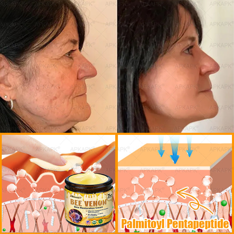 ⚡𝐌𝐇𝐑𝐀 𝐌𝐚𝐝𝐞 𝐚𝐧𝐝 𝐬𝐡𝐢𝐩𝐩𝐞𝐝 𝐟𝐫𝐨𝐦 𝐔𝐒𝐀✨𝗔𝗣𝗞𝗔𝗣𝗞® 𝗕𝗲𝗲 venom SkinRestoration Cream, Fine Lines, loss ofFirmness, Flat Bust, DroopingHips, and More