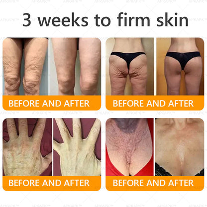 ⚡𝐌𝐇𝐑𝐀 𝐌𝐚𝐝𝐞 𝐚𝐧𝐝 𝐬𝐡𝐢𝐩𝐩𝐞𝐝 𝐟𝐫𝐨𝐦 𝐔𝐒𝐀✨𝗔𝗣𝗞𝗔𝗣𝗞® 𝗕𝗲𝗲 venom SkinRestoration Cream, Fine Lines, loss ofFirmness, Flat Bust, DroopingHips, and More