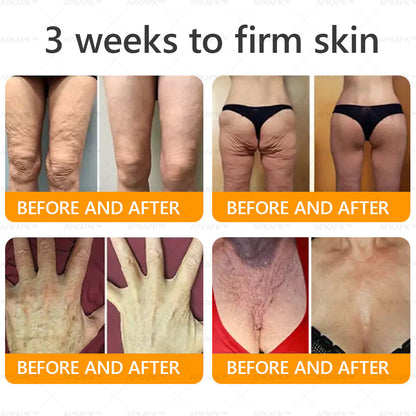 Made and Shipped from USA ✨✨✨  APKAPK® Bee venom Comprehensive Cream with Collagen & Matrixyl 3000|Obesity🔥 Sagging Skin, Fine Lines, Loss of Firmness, Flat Bust, Drooping Hips, and More