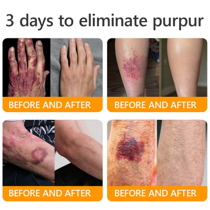 ⚡𝐌𝐇𝐑𝐀 𝐌𝐚𝐝𝐞 𝐚𝐧𝐝 𝐬𝐡𝐢𝐩𝐩𝐞𝐝 𝐟𝐫𝐨𝐦 𝐔𝐒𝐀✨𝗔𝗣𝗞𝗔𝗣𝗞® 𝗕𝗲𝗲 venom SkinRestoration Cream, Fine Lines, loss ofFirmness, Flat Bust, DroopingHips, and More